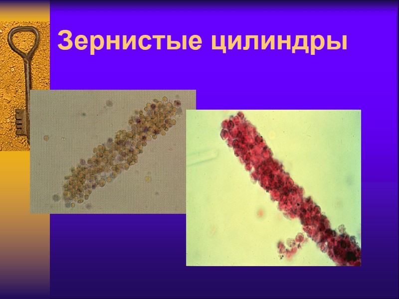 Зернистые цилиндры